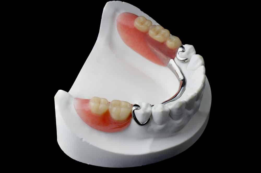What Are Partial Dentures? | FAQs Answered By Dr. Kaur