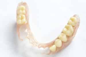 Removable Dentures