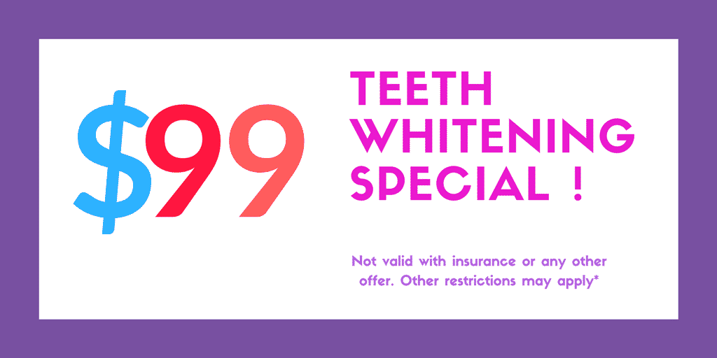 $99 Teeth Whitening Special