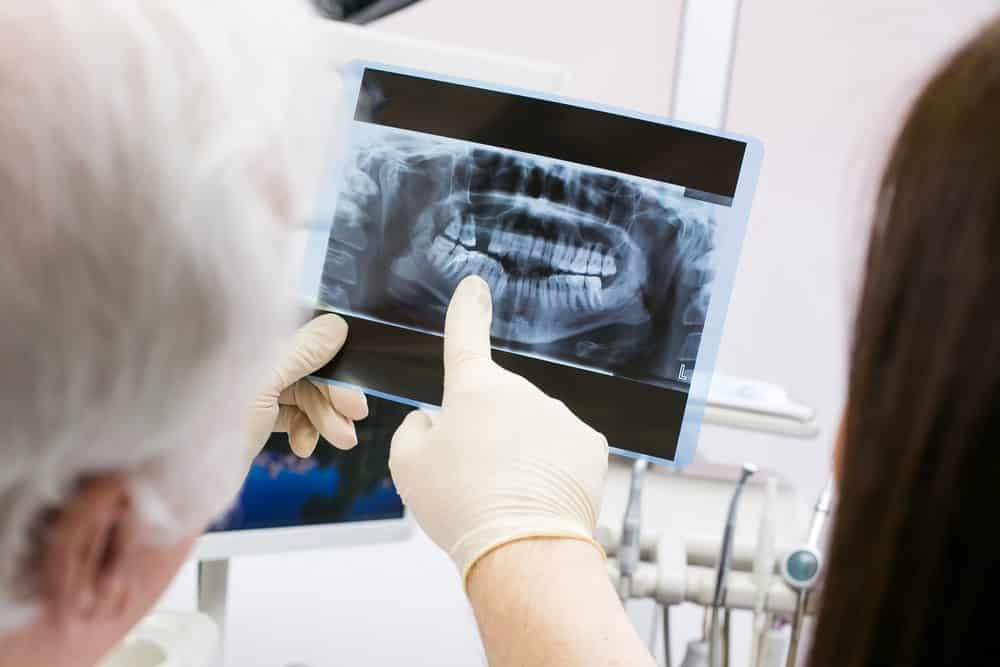 Dental X-Rays | FAQs Answered By Dr. Kaur