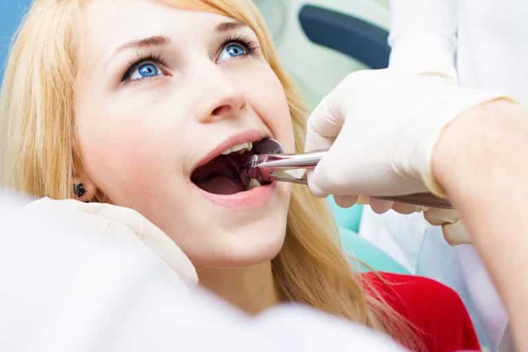 Tooth extraction, dental extraction