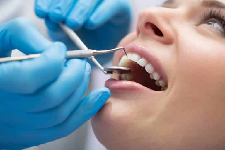Deep Tooth Cleaning