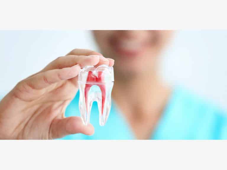 root canal treatment